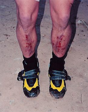 Juds legs after 45 minutes in the Buckskin Ice